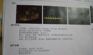 nt是什么梗