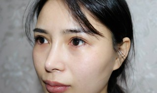 眼袋怎么去掉 女人眼袋怎么去掉