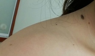 锁骨上有痣代表什么（女生右锁骨上有痣代表什么）