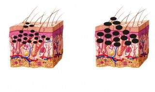 怎样才能祛斑 祛斑美白最佳方法