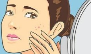 脸上长斑如何调理 脸上长斑怎么调养