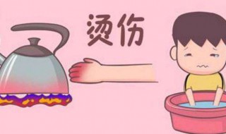 被火烫了怎么解决 被热烫了怎么办
