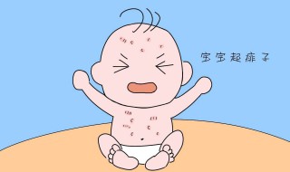宝宝长痱子用什么擦好 宝宝长痱子用什么擦效果好