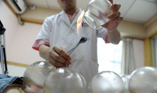 拔罐出水泡怎么回事（后背拔罐出水珠怎么回事）