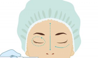 怎样能除去眼袋 怎样能除去眼袋的方法