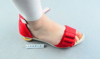 脚掌底摩擦起包怎么处理 脚掌底摩擦起包怎么处理好得快