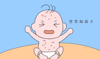 去痱子的最快方法（去痱子的最快方法介绍）