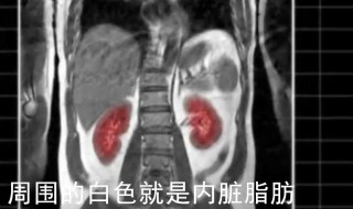 怎么知道是不是内脏脂肪多（怎么知道自己是不是内脏脂肪多）