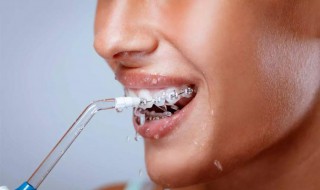冲牙器正确使用方法 冲牙器正确使用方法图解