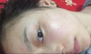 斑怎样才能清除（斑怎么才能去除）