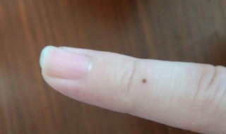 苍蝇屎在脸上怎么去掉 苍蝇屎在脸上怎么去掉小妙招